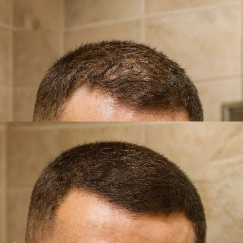 HAIRO Fibre densifiante - Brun Foncé